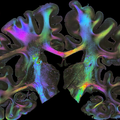 TU Delft joins EBRAINS: advancing brain research and innovation