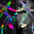 Nieuw licht op sterk vervlochten zenuwvezels in de hersenen