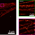 Combination of microscopy techniques makes images twice as sharp